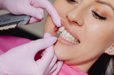 Why Veneers Are Booming, and Why Dentists Are Worried About Where People Get Them