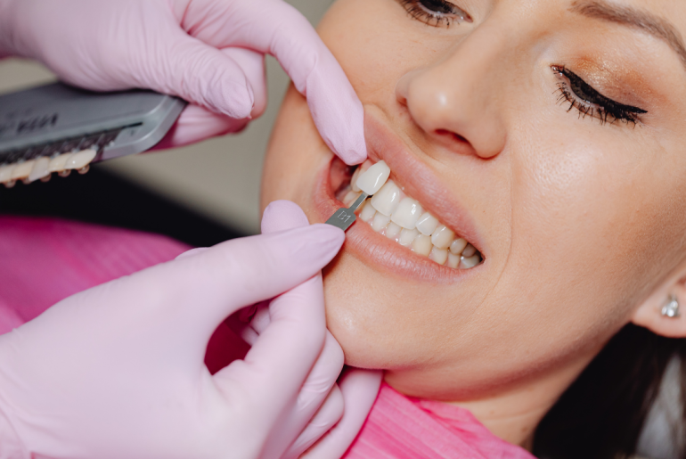 Why Veneers Are Booming, and Why Dentists Are Worried About Where People Get Them